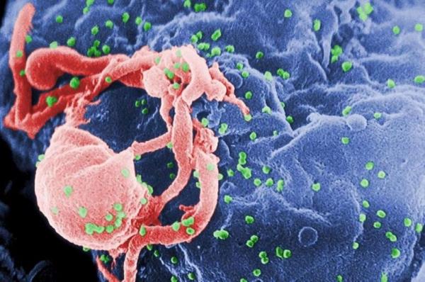 为什么并存病持续存在:HIV感染在细胞中留下了“记忆”